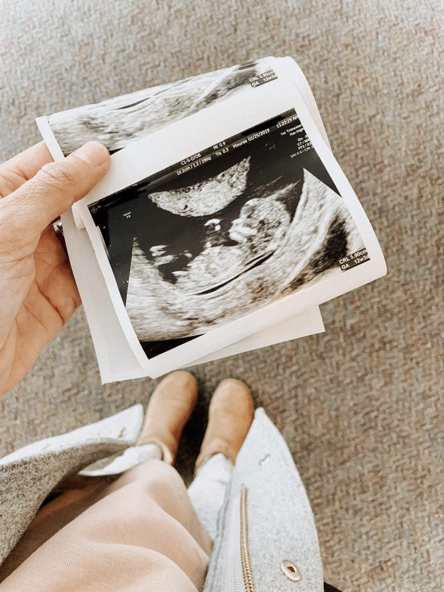 Gender Reveal, ultrasound