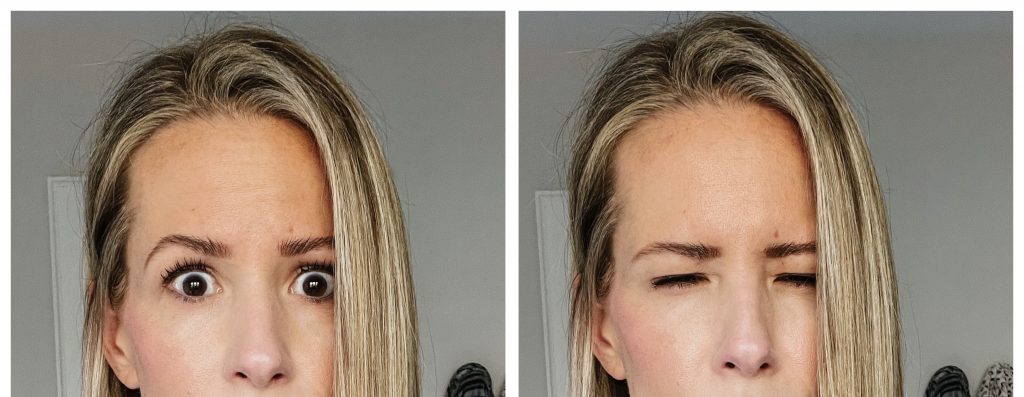 Botox, after