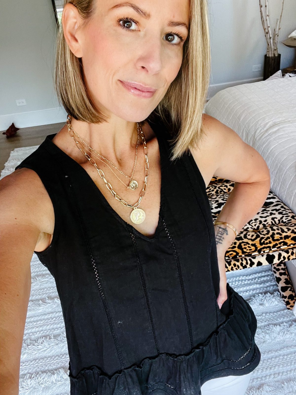 Botox Before + After | Your Questions Answered